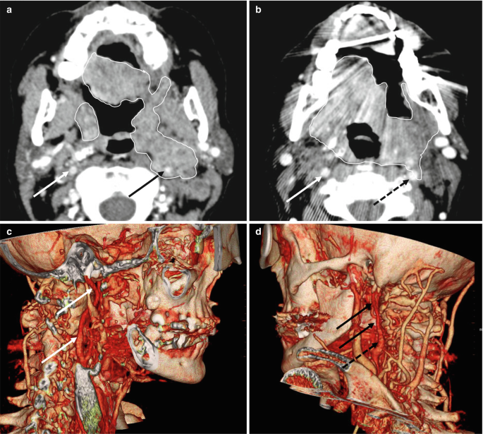 figure 24