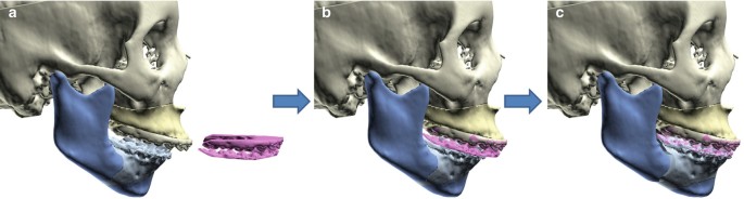 figure 24