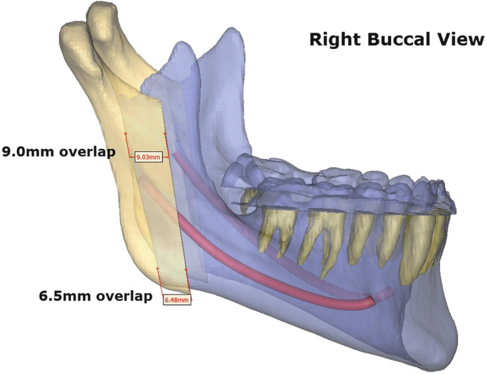 figure 44