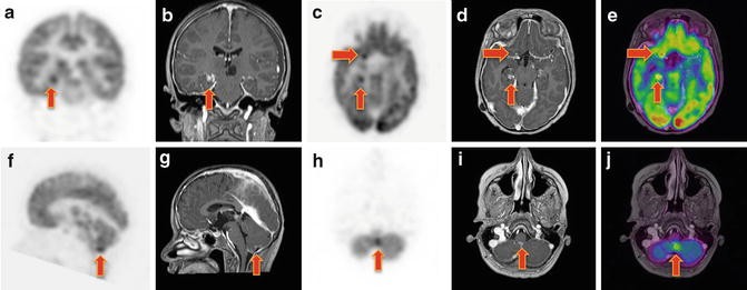 figure 16