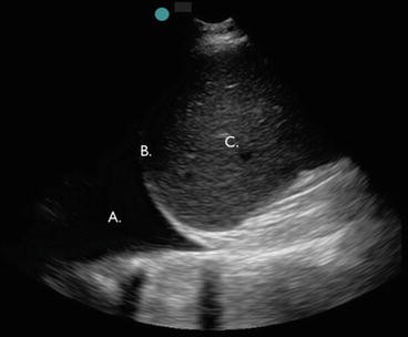 figure 23