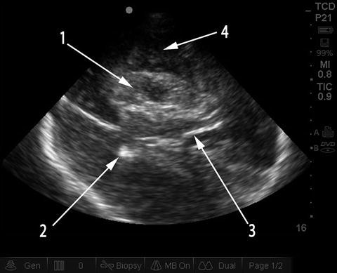 figure 25