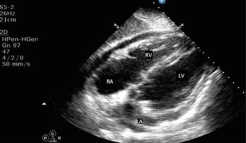 figure 15