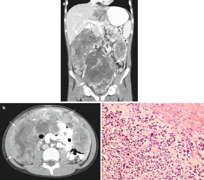 figure 23