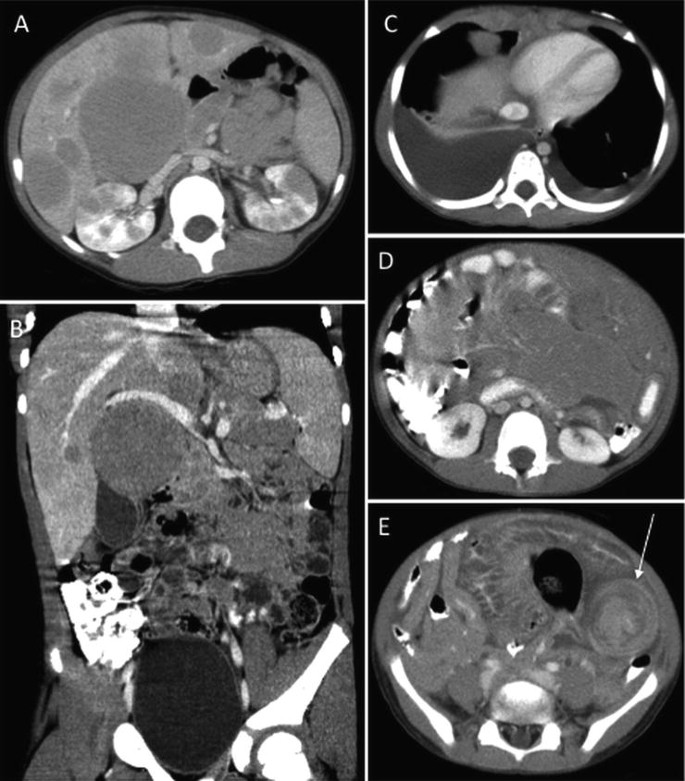 figure 28