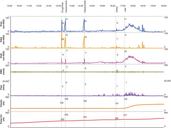 figure 17