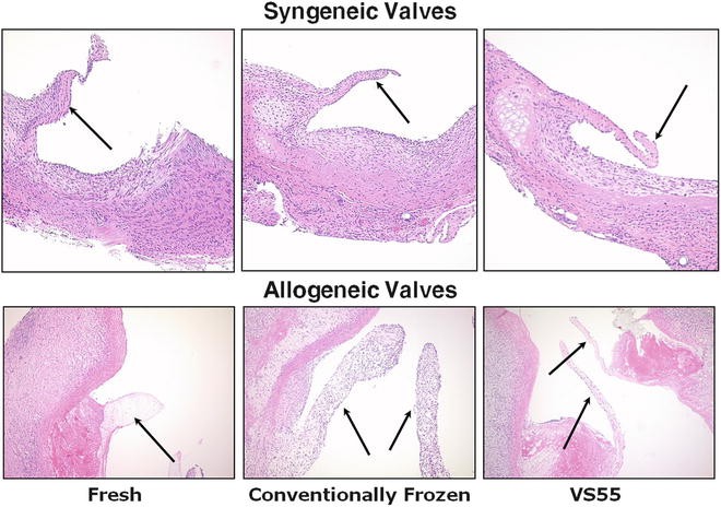 Vitrification of Heart Valve Tissues | SpringerLink