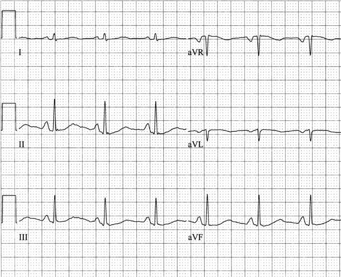 figure c