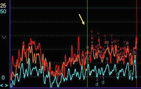 figure 16