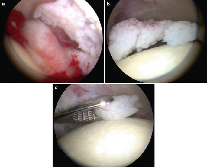 figure 18