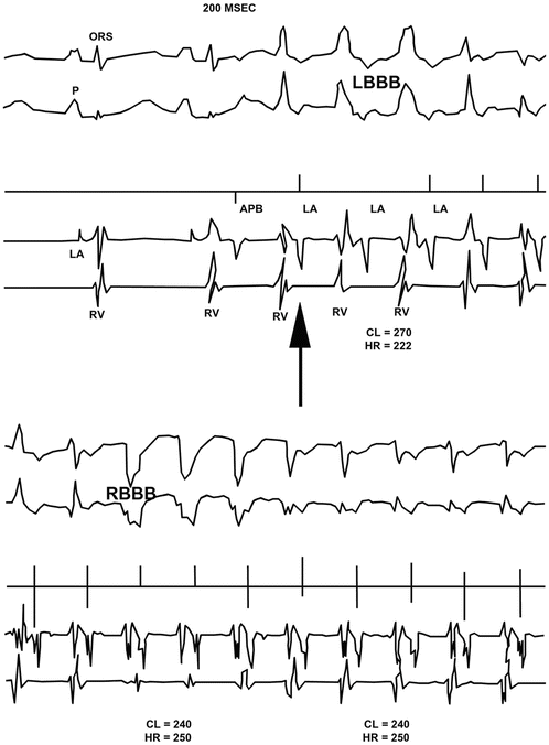 figure 18