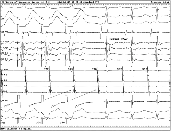 figure 21