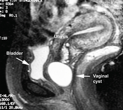 figure 28