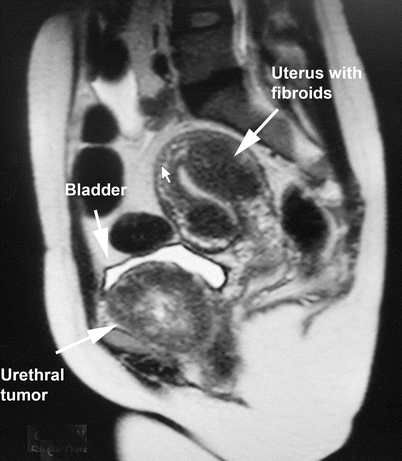 figure 43