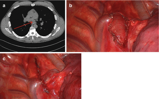 figure 16