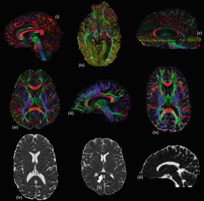 figure 22