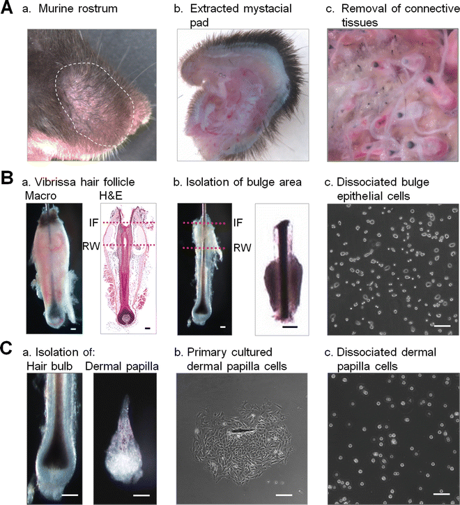 Hair Follicle Regeneration by Transplantation of a Bioengineered Hair Follicle Germ | SpringerLink Hair Follicle Regeneration by Transplantation of a Bioengineered Hair Follicle Germ | SpringerLink