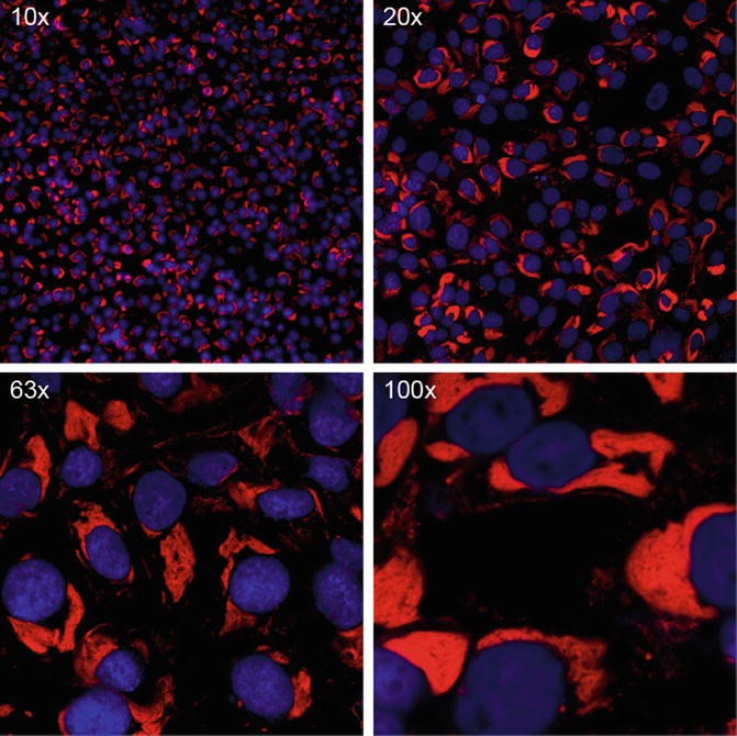 Turbo FISH: A Method for Rapid Single Molecule RNA FISH