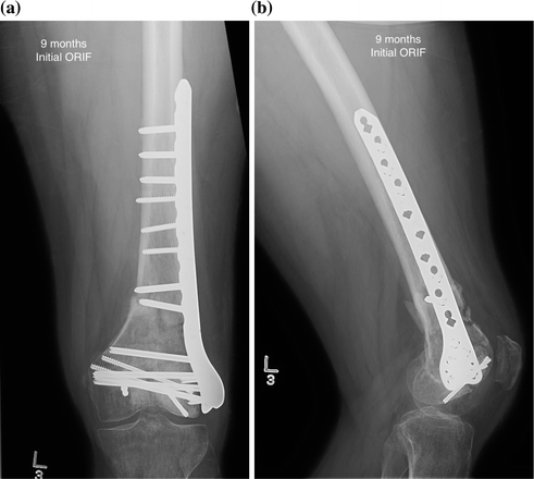 figure 14