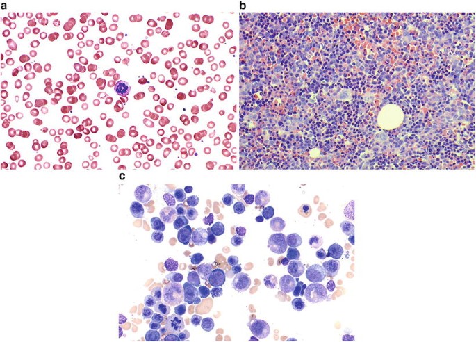 figure 29