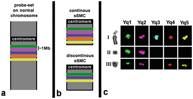 Chromothripsis Detectable in Small Supernumerary Marker Chromosomes (sSMC)  Using Fluorescence In Situ Hybridization (FISH) | SpringerLink