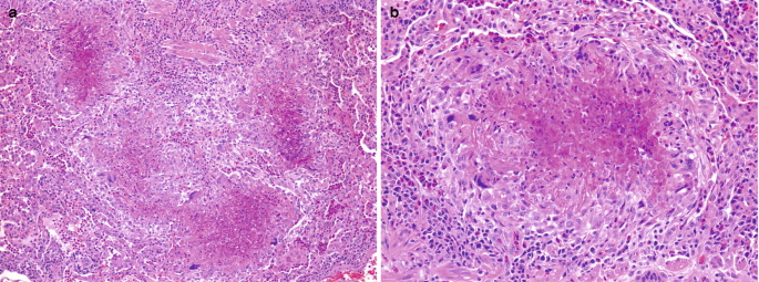 figure 31