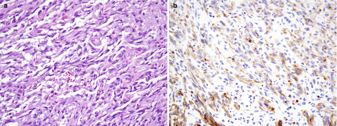 figure 46