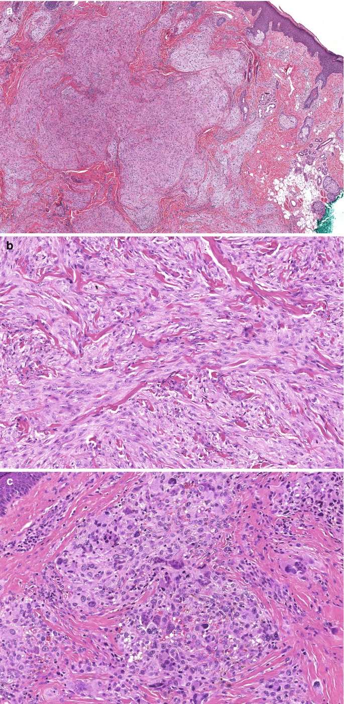 figure 29