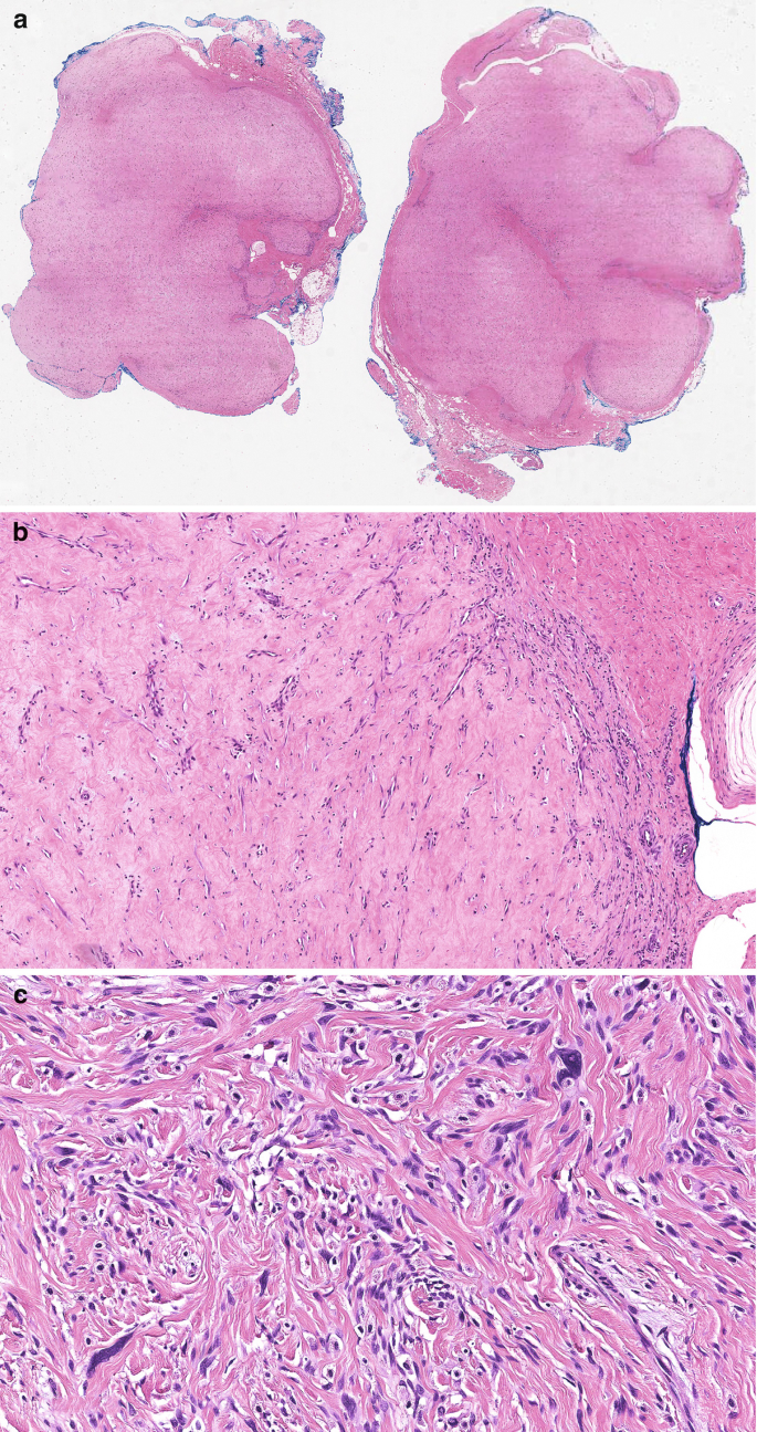 figure 33