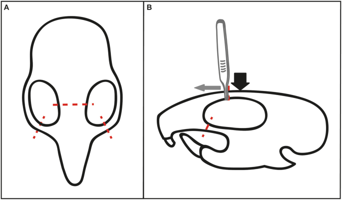 Nose picking is major source of S. pneumoniae colonization