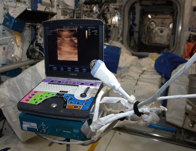 Diagnostic Imaging in Space Medicine | SpringerLink