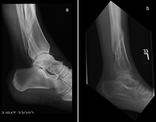 Imaging Approach to Musculoskeletal Trauma | SpringerLink