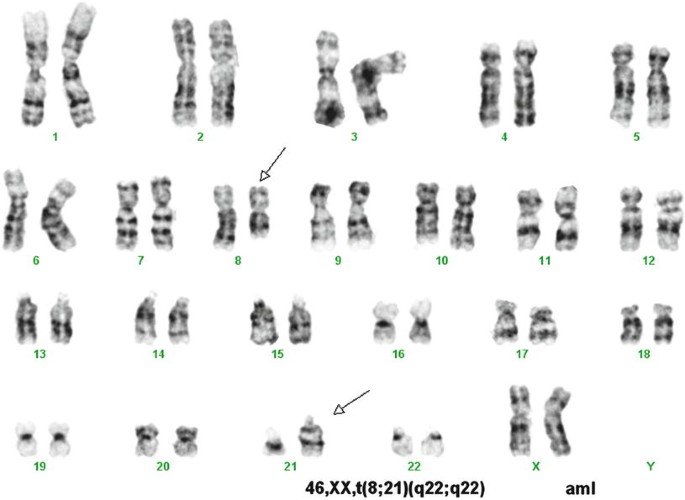 Molecular Biology Of Leukemias Springerlink