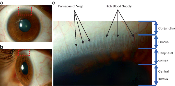 Corneal Epithelial Stem Cells and Their Therapeutic Application |  SpringerLink