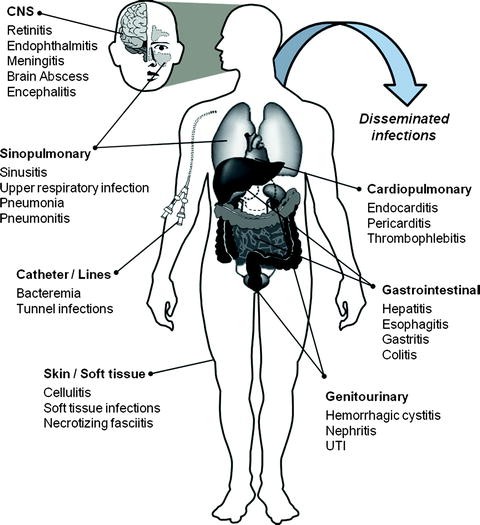 figure 1_12