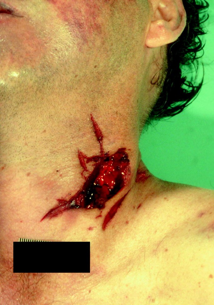 Barbed Wire Neck Wound Stick On Mutilations Unisex Barbed Wire Neck Wound Stick On Mutilations Unisex