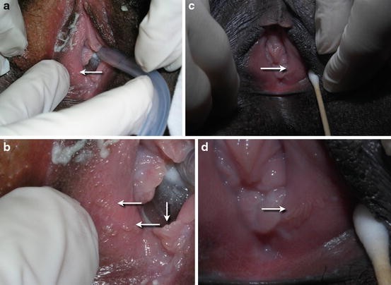 pussy comparaison rape 