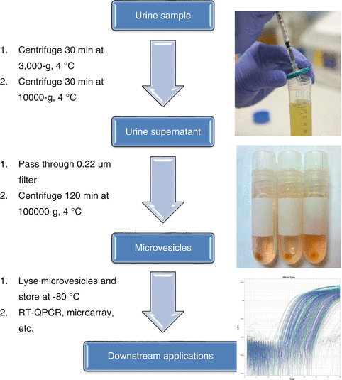 Methods of MicroRNA Quantification in Urinary Sediment | SpringerLink