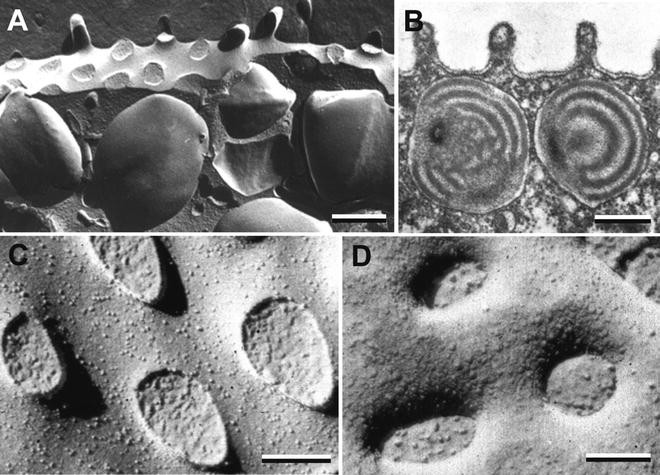 Microscopie électronique et cryofracture - Transform