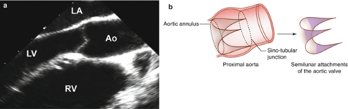 figure 00113