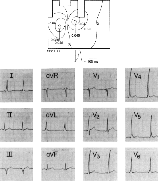 figure 22