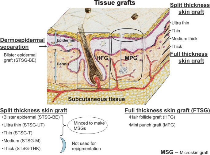 figure 1_3