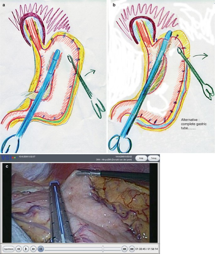 figure 9_6