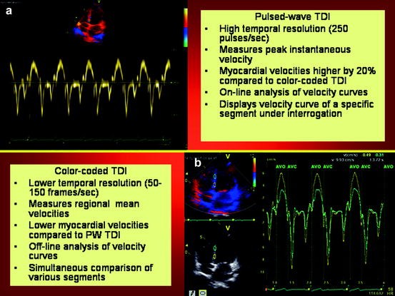 Tissue Doppler Imaging and Strain Echocardiography | SpringerLink