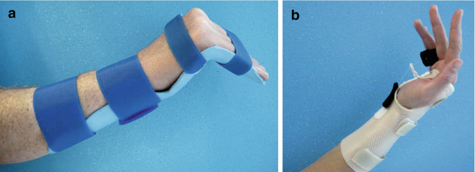 Chronic Finger Injuries