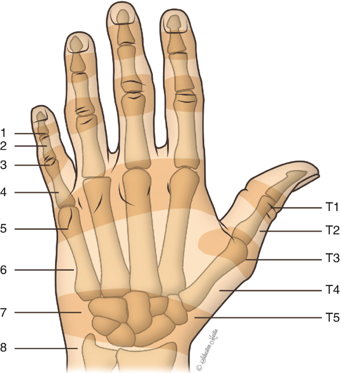 Chronic Finger Injuries | SpringerLink
