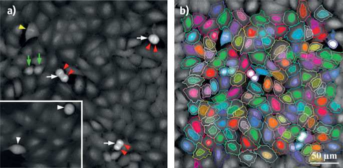 figure 35