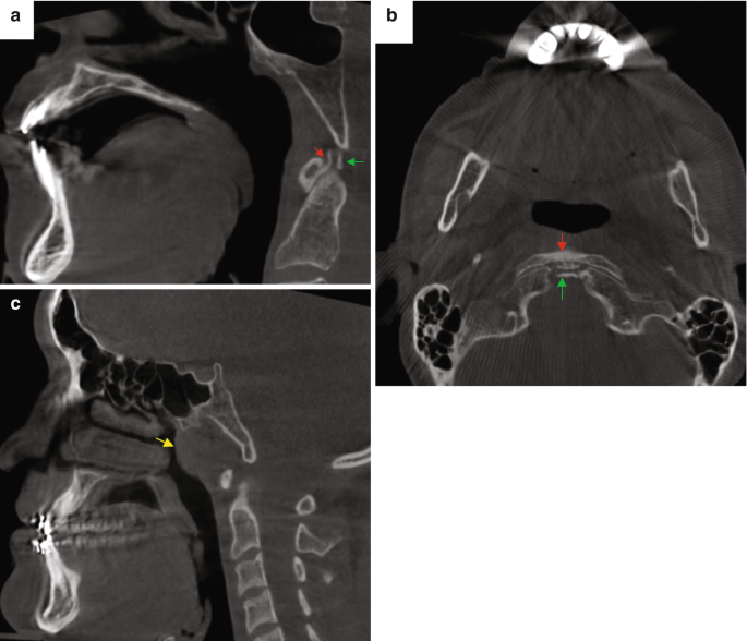 figure 15