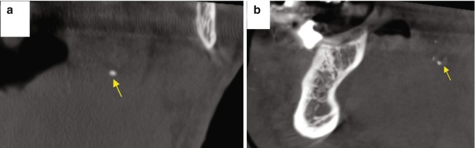 figure 22