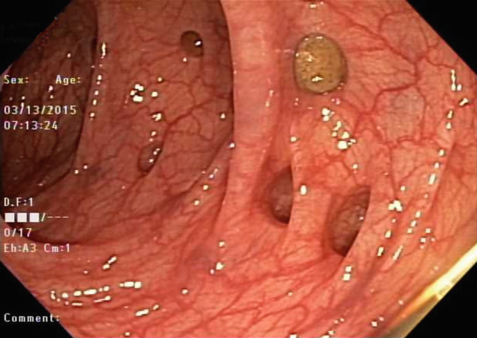 Endoscopy | SpringerLink